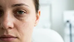 Jak pozbyć się cieni pod oczami bez drogich kremów – 7 prostych zasad od eksperta