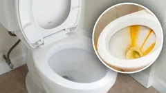 Wieloletni osad zniknął z toalety: pomogła domowa mieszanka z trzech składników